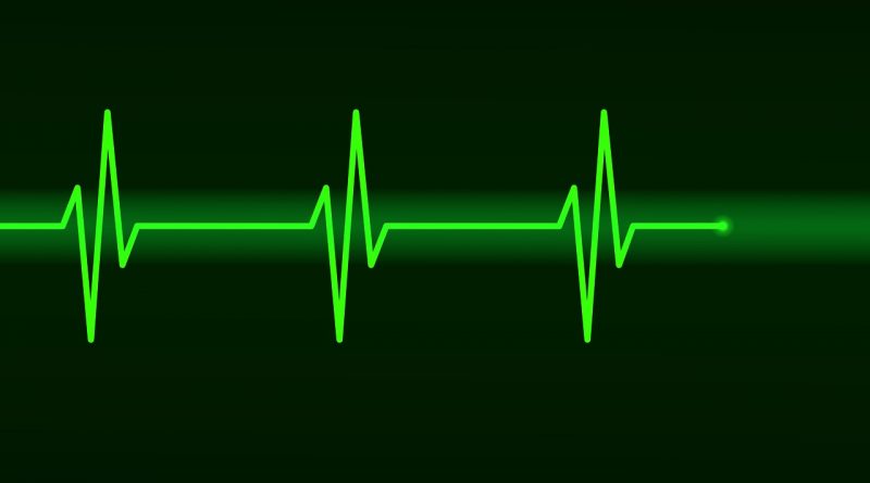 alivecor